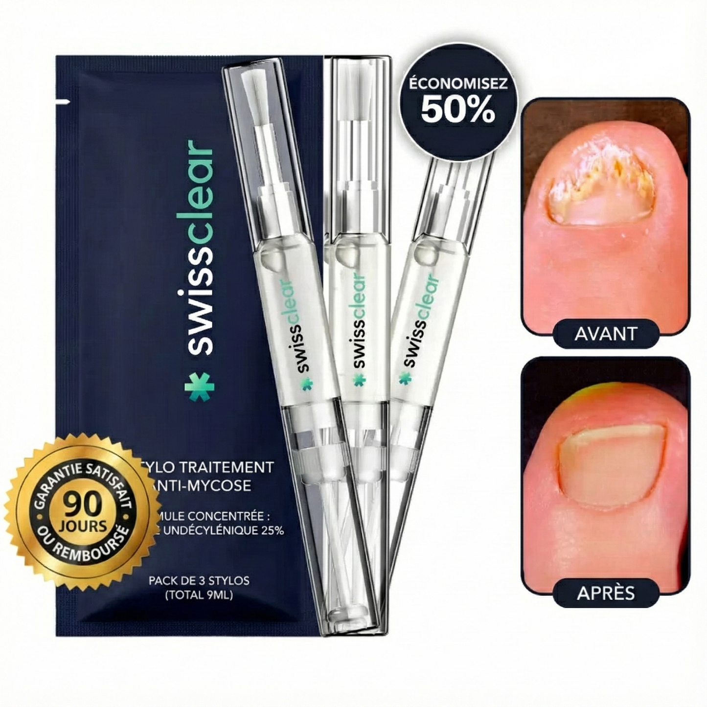 تخلّص من فطريات الأظافر في 3 أسابيع فقط