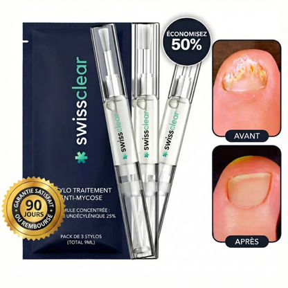 تخلّص من فطريات الأظافر في 3 أسابيع فقط