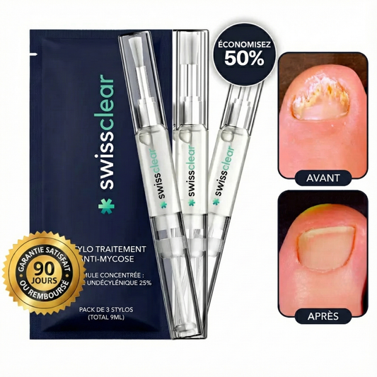 تخلّص من فطريات الأظافر في 3 أسابيع فقط